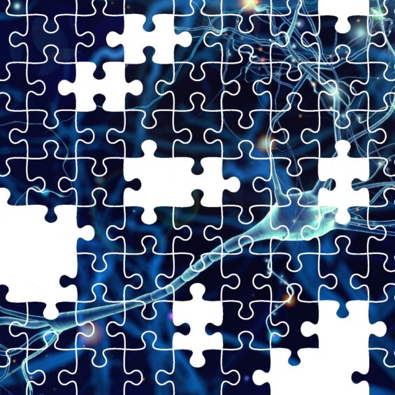 puzzle brain picture